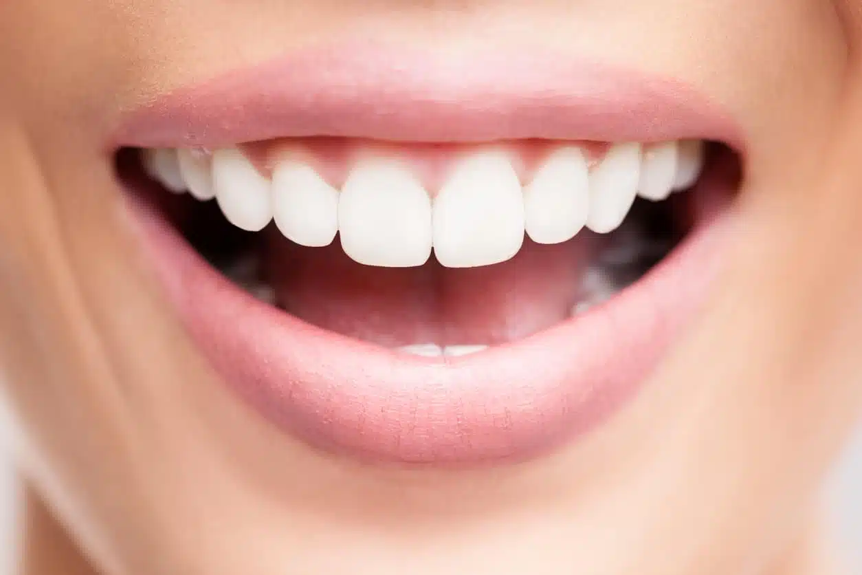 Femme souriante avec des dents blanches