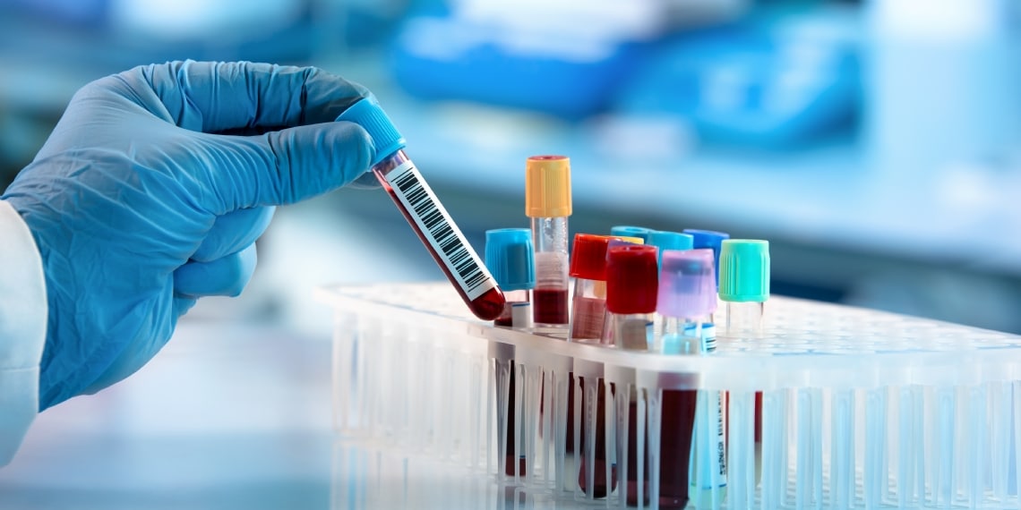 Famille étonnée par des résultats médicaux