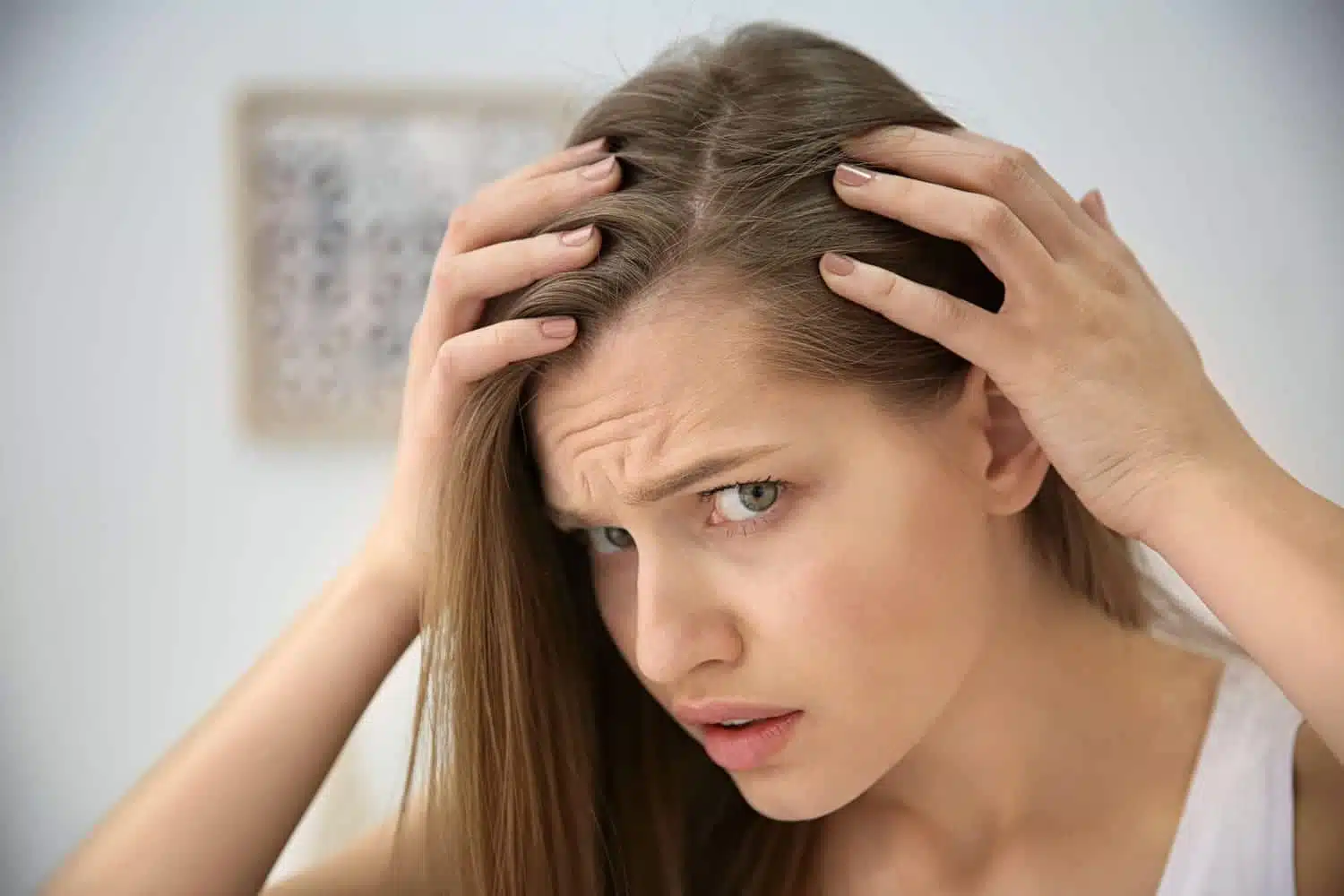 Pityriasis du cuir chevelu
