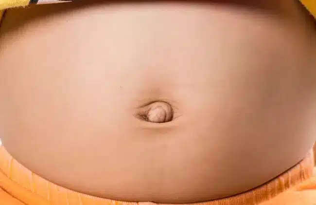 Illustration d'un nombril peu profond