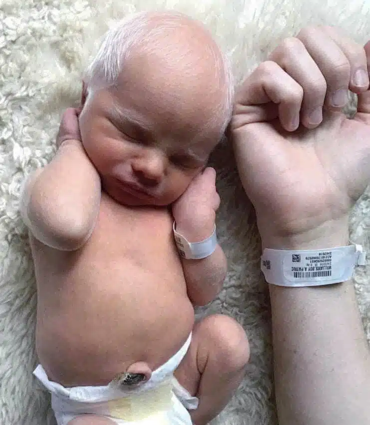 Redd, enfant albinos aux cheveux blancs et yeux bleus intenses