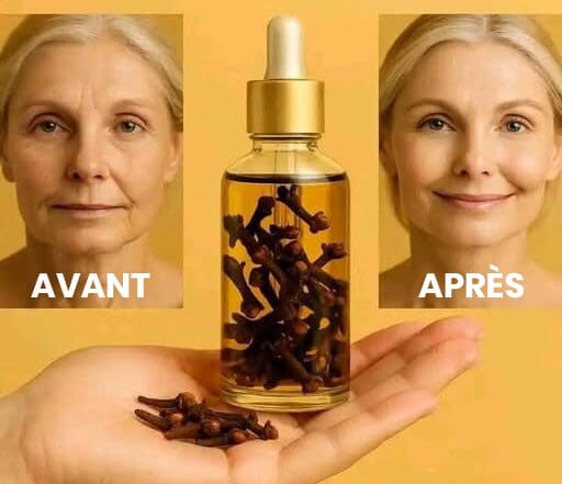 Clou de girofle et soin beauté naturel