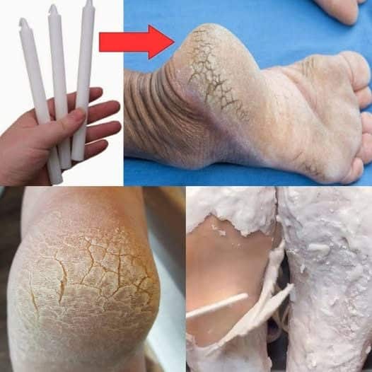 Illustration d'un soin de pieds relaxant