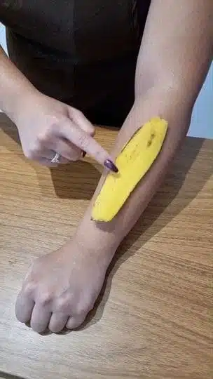 Application de peau de banane sur une irritation