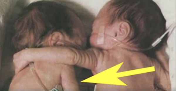 Ce bébé est entrain de mourir