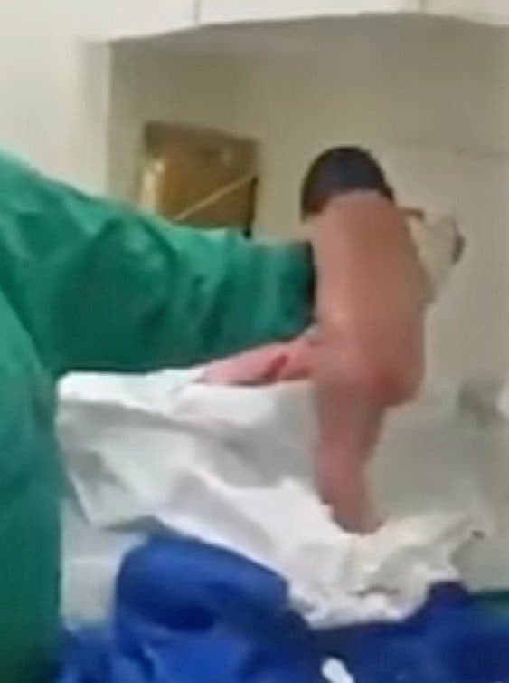 Ce nouveau-né surprend le monde quand il marche sur le lit de sa naissance 