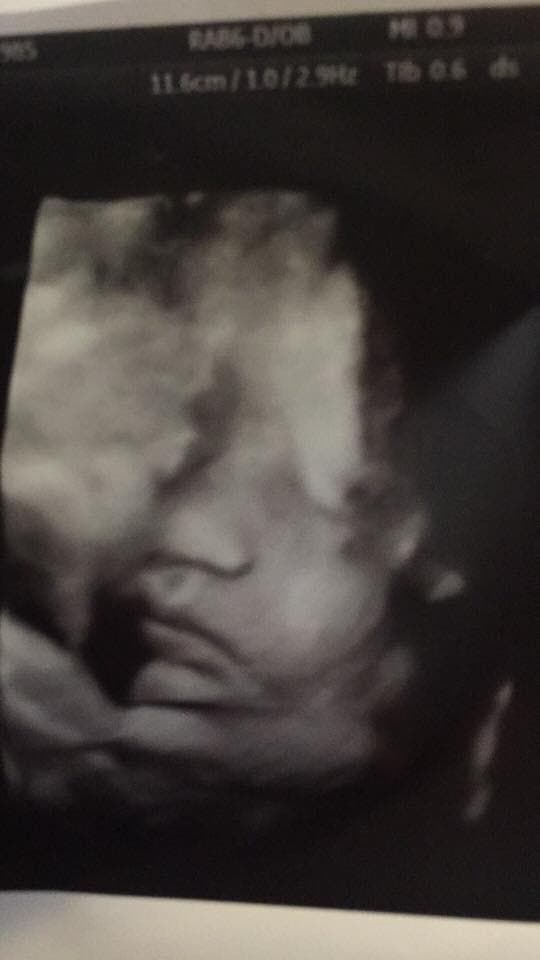 Cette mère annonce qu’elle est enceinte aux funérailles de son mari