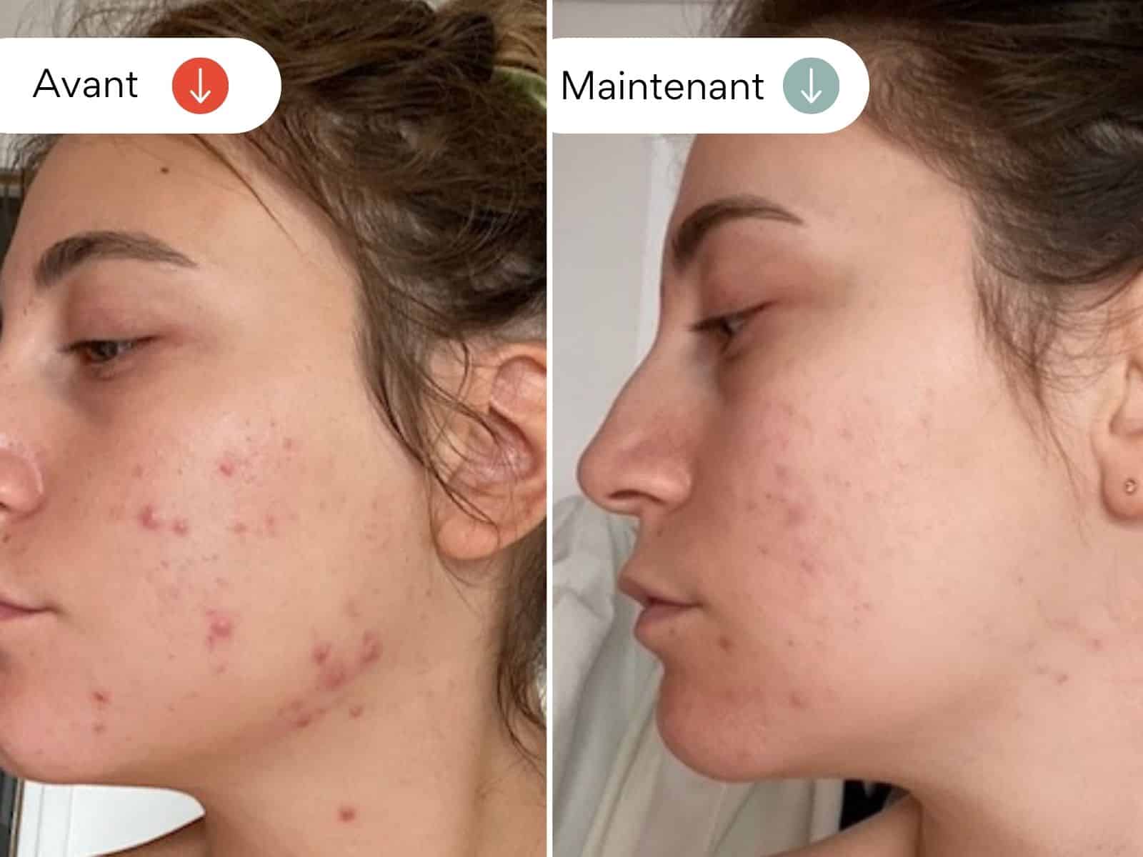 Soin peau au miel