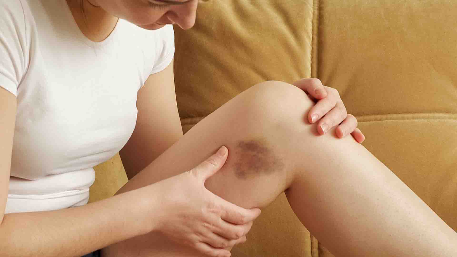 teinte bleutée sur les doigts indiquant un problème circulatoire