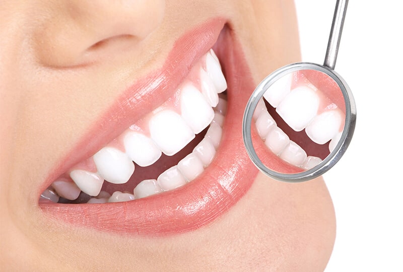 Dents blanches et sourire éclatant