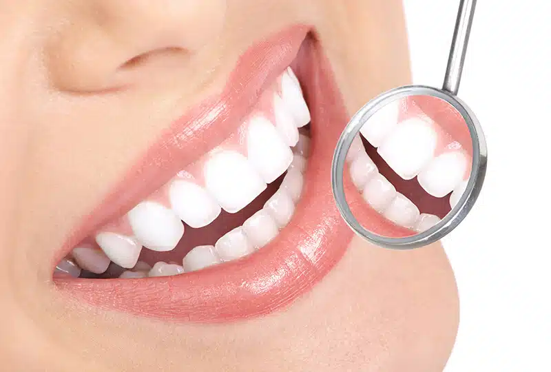 Dents blanches et sourire éclatant