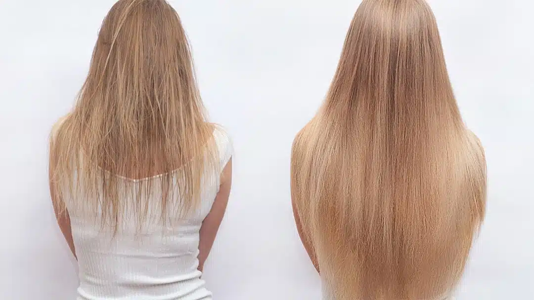 Femme massant son cuir chevelu avec de l'huile