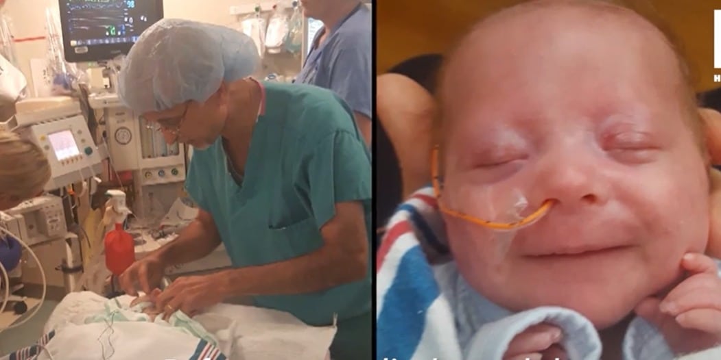 Mathieu, bébé prématuré, entouré de câbles médicaux en néonatologie