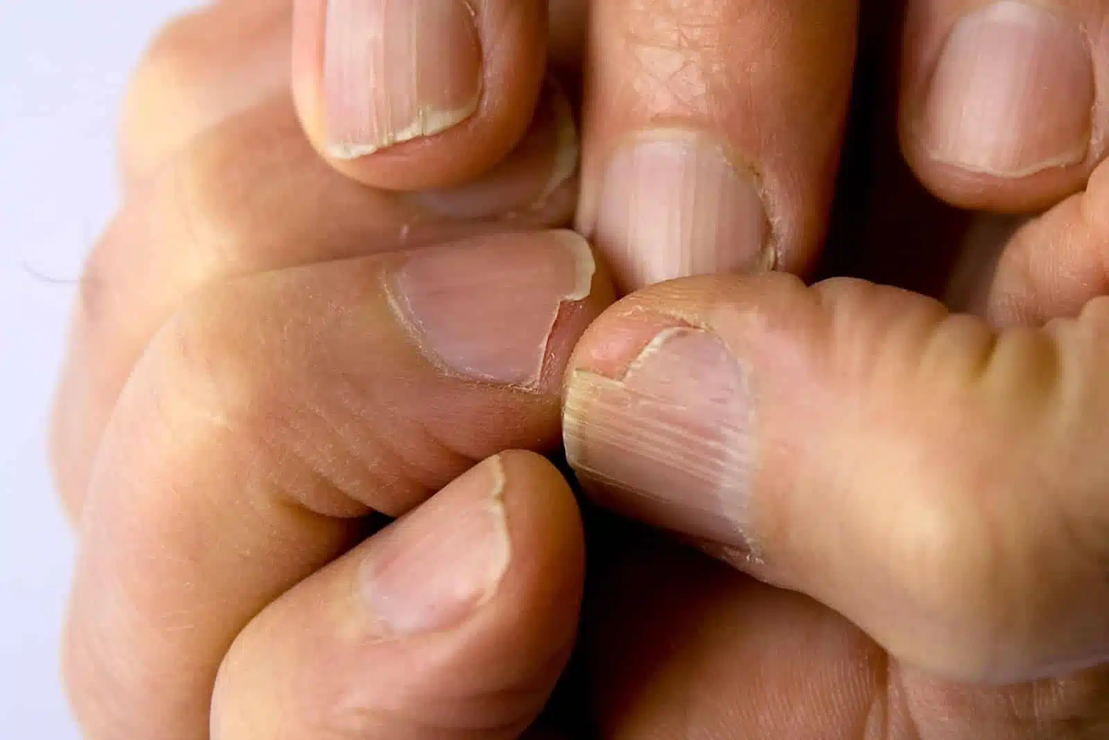 Ongles cassants et soins naturels