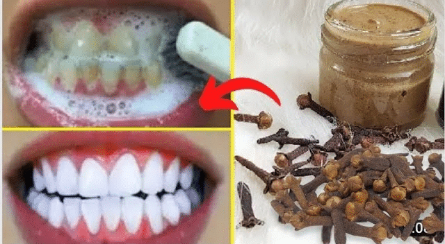 Comparaison avant/après traitement naturel