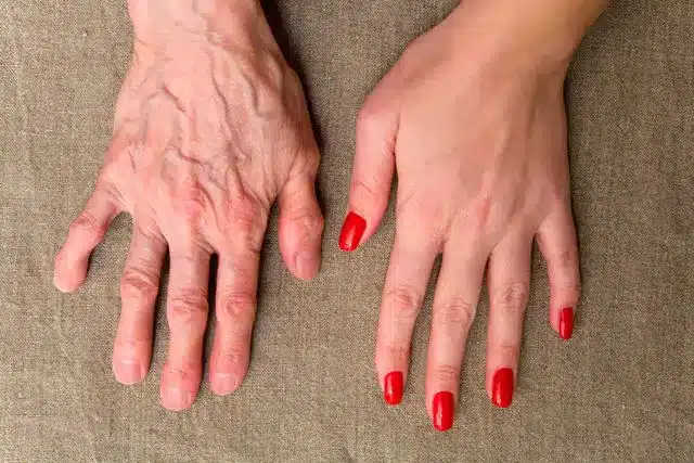 Femme prenant soin de ses mains