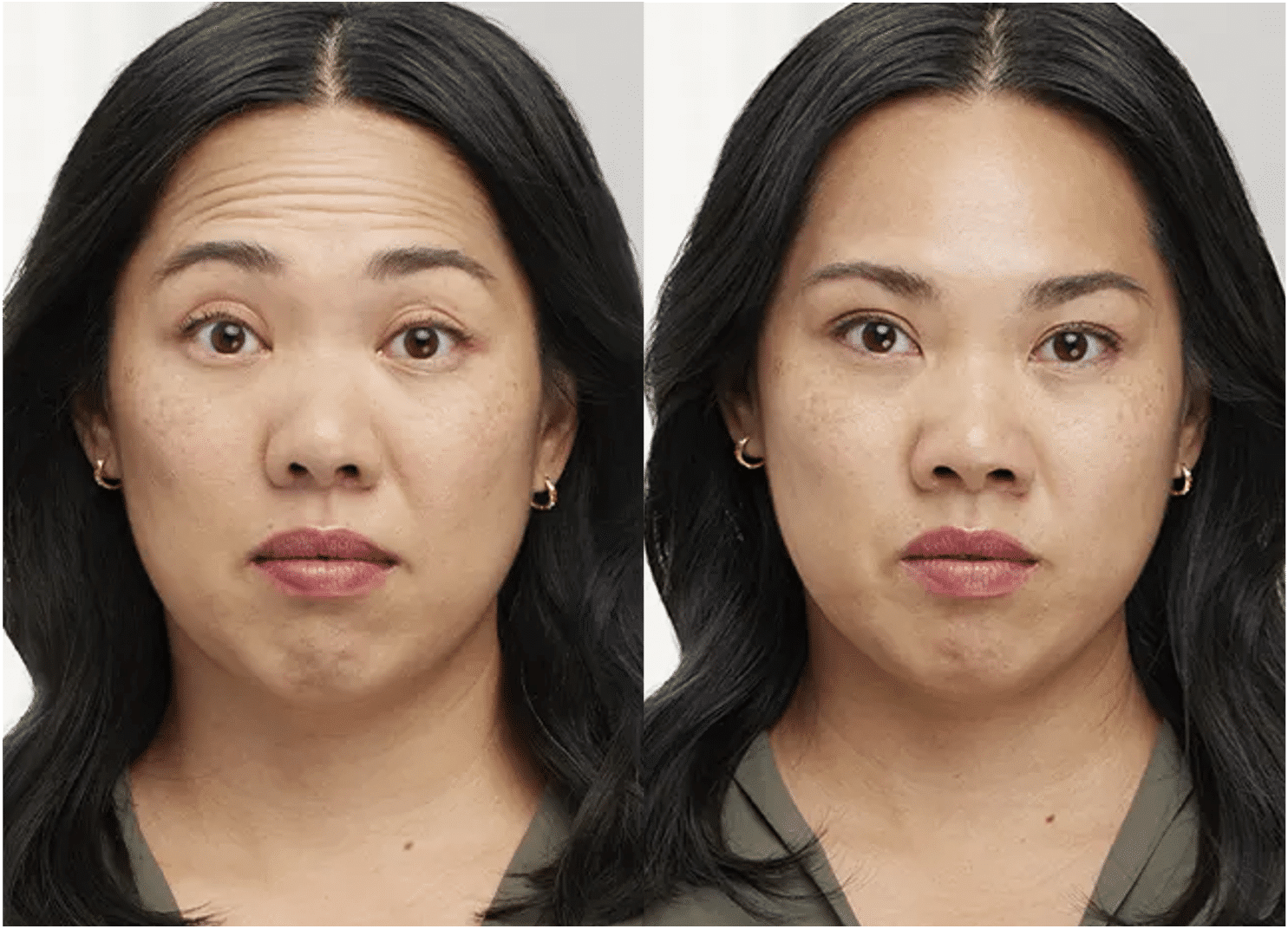 Comparaison avant/après masque purifiant