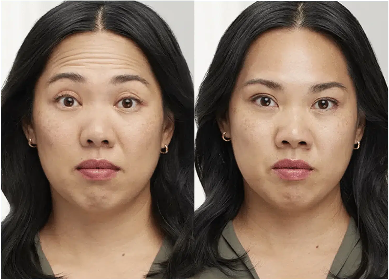 Comparaison avant/après masque purifiant