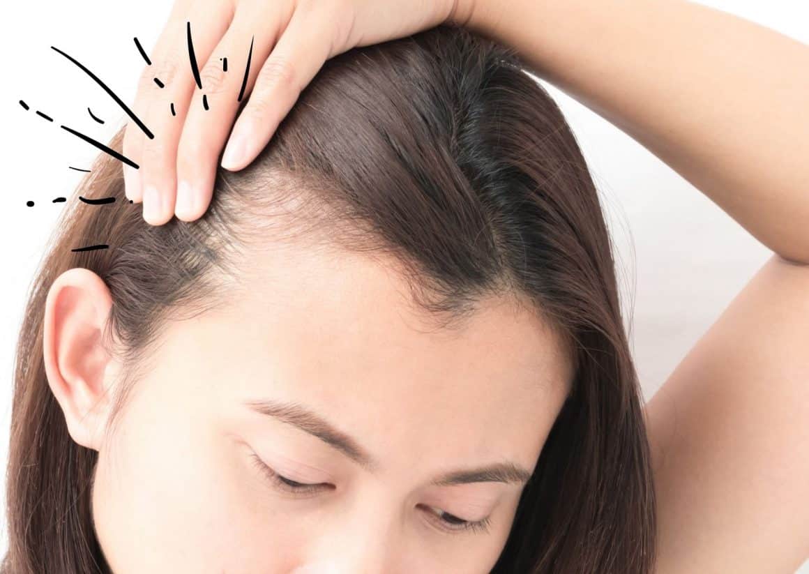 femme aux cheveux fins et cassants