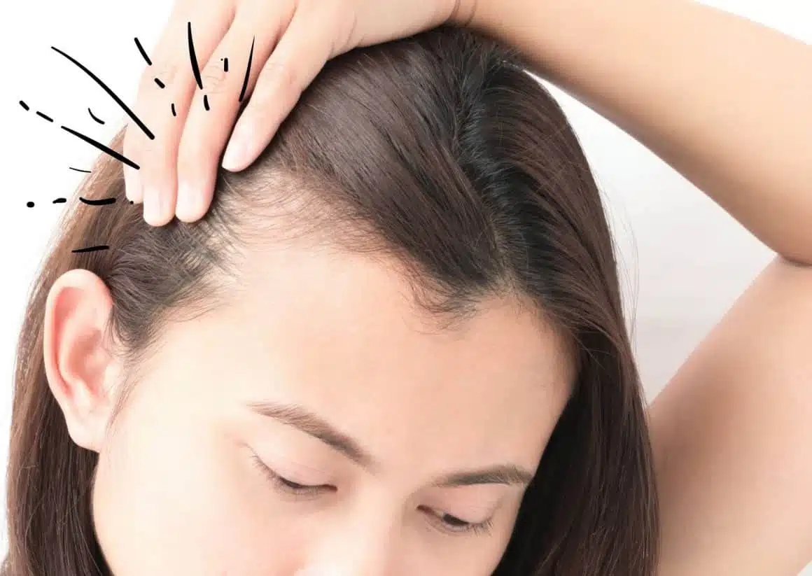 femme aux cheveux fins et cassants