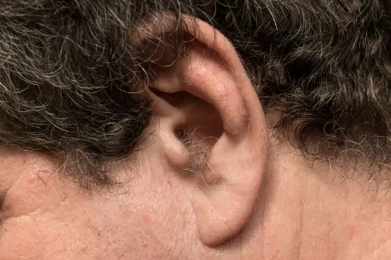 Détail de poils dans l'oreille