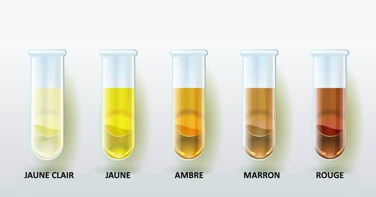 Diagramme des couleurs d'urine et leur signification