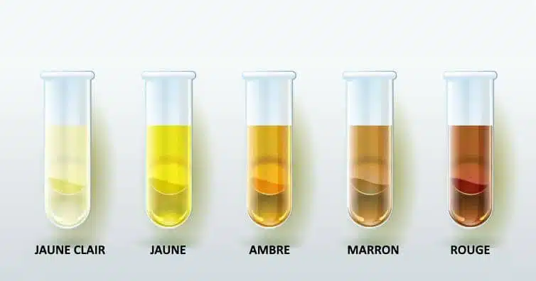 Diagramme des couleurs d'urine et leur signification