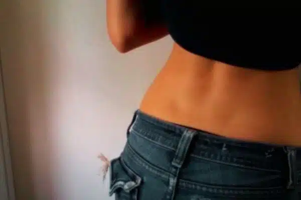 Présence des fossettes selon le genre