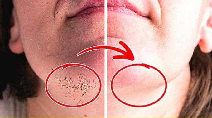 Femme consultant une dermatologue