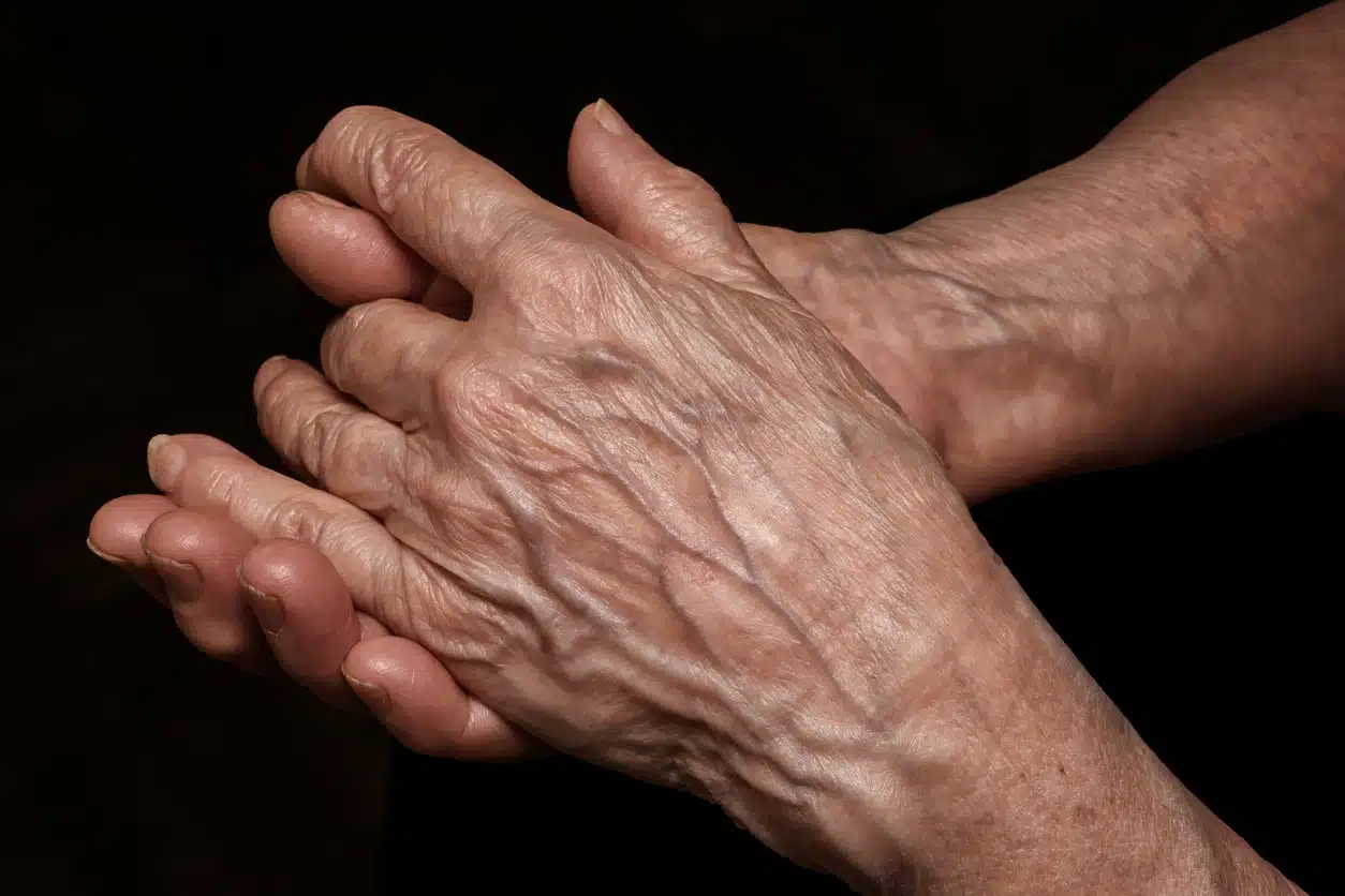 Détail de veines sur une main