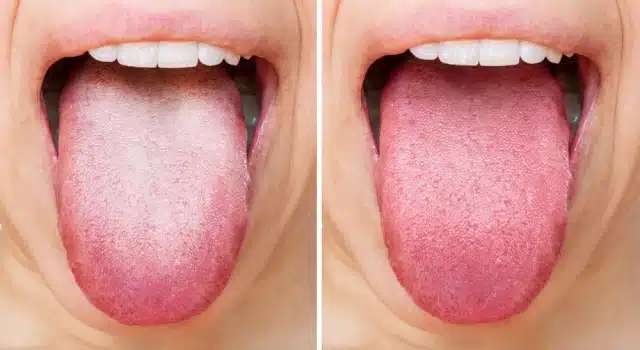Conseils pratiques pour une langue saine