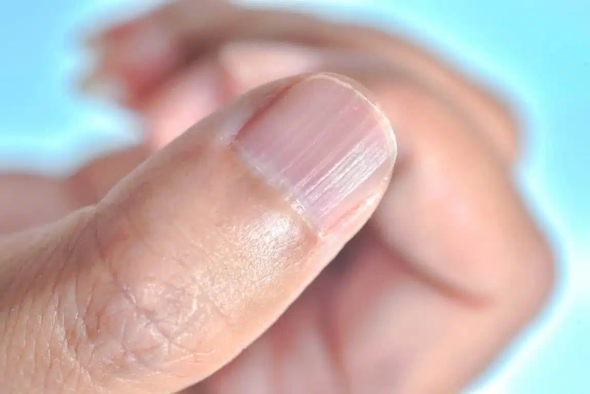 Ongles striés