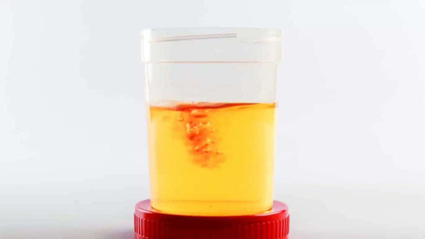 Illustration de symptômes digestifs