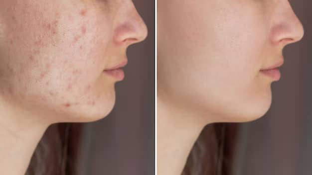 Transformation d'une peau à problèmes après soins naturels