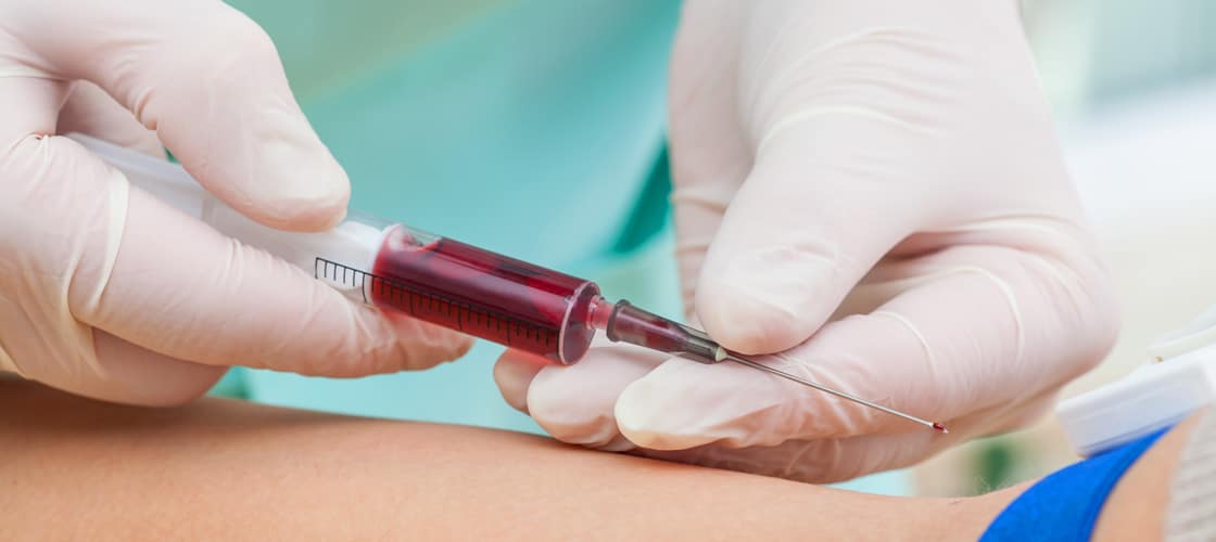 Laboratoire d'analyses sanguines