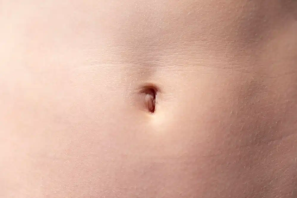 Illustration d'un nombril de forme ronde