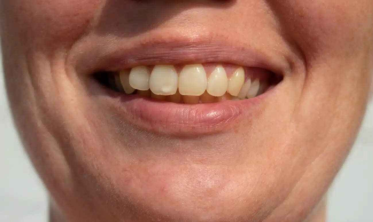 Femme souriant et montrant ses dents
