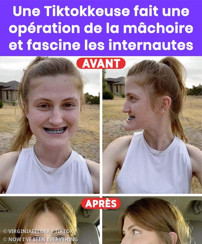 Virginia partage son expérience post-opératoire