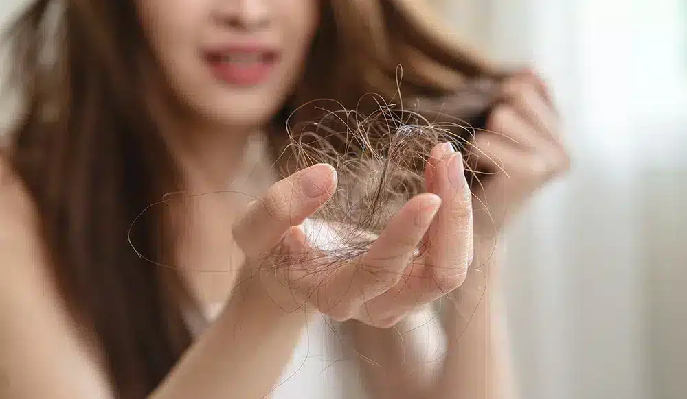 Chute de cheveux et solutions nutritionnelles